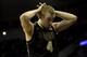 Hummel was considered an NBA prospect, but has had multiple setbacks due to injury.