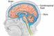 The brain floats within a small buffer of cerebrospinal fluid (CSF). Photo courtesy of healthcentral.com.