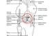 The above diagram shows the basic anatomy of the knee. The red circle highlights the ACL. Photo from Wikimedia Commons and edited by the author.