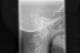 The cervical spine is a set of seven bones that encases and protects the spinal cord at the level of the neck. Photo from Wikimedia Commons.