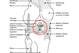 The ACL, highlighted here by the red circle, is one of the four main stabilizing ligaments of the knee.