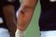 Baltimore- Sep 24: A view of a Baltimore Ravens player with a bloody arm taken during a NFL game against the Cincinnati Bengals at PSINET Stadium in Baltimore, Maryland on September 24, 2000. (Photo by M David Leeds/Getty Images)