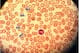 Platelets, seen here amongst red blood cells and highlighted by blue arrows, carry many proteins crucial for the body's healing process.