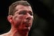 BRISBANE, AUSTRALIA - DECEMBER 07: Anthony Perosh of Australia spits blood after his loss against Ryan Bader of the USA in their light heavyweight fight during the UFC Fight Night event at Brisbane Entertainment Centre on December 7, 2013 in Brisbane, Au