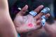 MELBOURNE, AUSTRALIA - JANUARY 22: A trainer treats the blister on the hand of Rafael Nadal of Spain in his quarterfinal match against Grigor Dimitrov of Bulgaria during day 10 of the 2014 Australian Open at Melbourne Park on January 22, 2014 in Melbourn