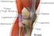 This diagram shows the location of the menisci within the knee.