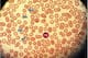 Platelets, highlighted here by blue arrows and sitting amongst many red blood cells, carry many different types of healing proteins.