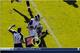 After a shove to his left side, Sam Bradford's momentum and the direction his toes and knee faced fell out of sync, causing his ACL tear.