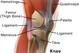 During arthroscopic knee surgery, a surgeon can visualize and treat many different problems—such as meniscal tears.