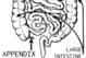 This diagram shows a crude representation of the intestines within the lower abdomen as viewed from the front. It shows the location, shape and relative size of the appendix.