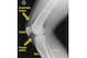 This X-ray shows the knee as viewed from the side. The two yellow arrows show the approximate location of the quadriceps and patellar tendons.