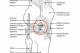 This diagram shows the basic anatomy of the knee as viewed from the front and outside. The red circle highlights the location of the ACL.