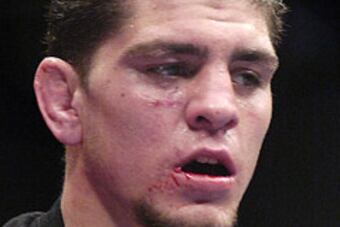 Nick-diaz2010_original_crop_north