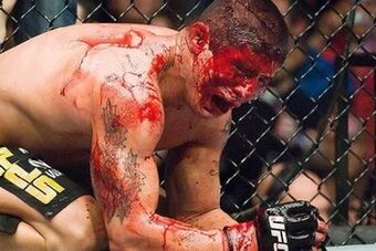 Ufc-blood_crop_north