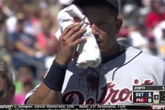Video: Bloody Miguel Cabrera Leaves Game, Will Miss Two Weeks