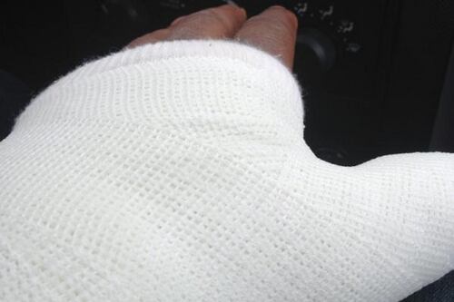Michigan Football: Kenny Demens Pulls April Fools' Prank with Hand in Cast