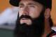 Brian Wilson says his elbow hasn't been right since 2010.