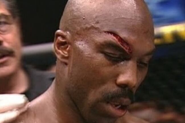 Worst-cut-in-ufc-mma-history-belfort-vs-eastman_crop_north