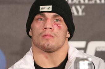 Jake-ellenberger-ufc-126-post_display_image_crop_north