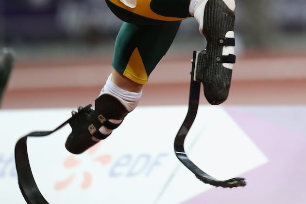 Pistorius Apologises for Outburst