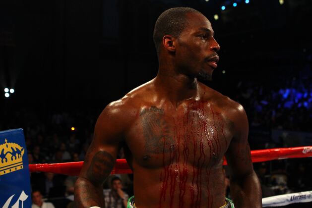 Ward vs. Dawson: Matchup Finally Gives Fans Something to Be Excited About