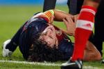 Barcelona Star Suffers Gruesome Arm Injury (Graphic)