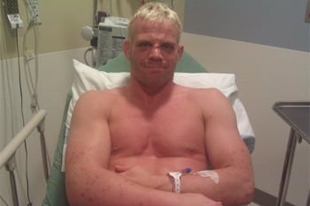 Dennis Hallman Misses Weight by a Mile, Fight with Thiago Tavares Canceled