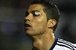 Portugal Pulls Out Ronaldo Due to Eye Injury
