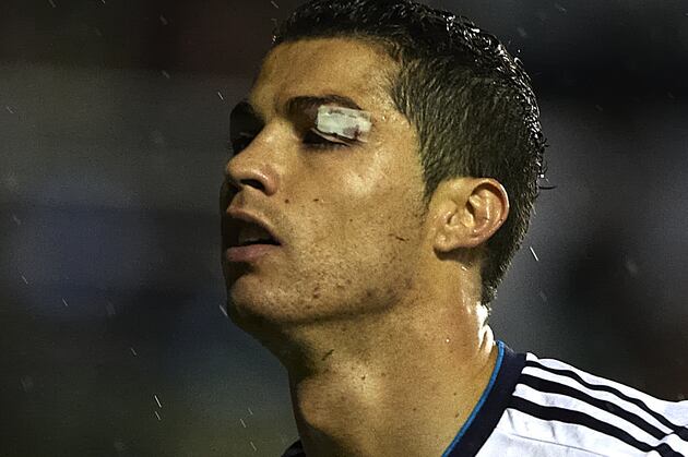 Portugal Pulls out Cristiano Ronaldo Due to Eye Injury