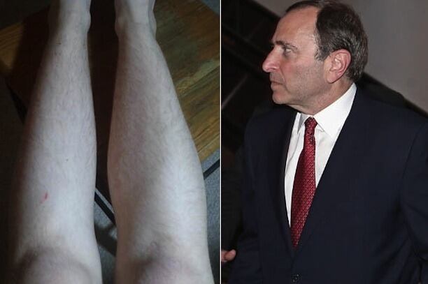 Girl Won't Shave Legs