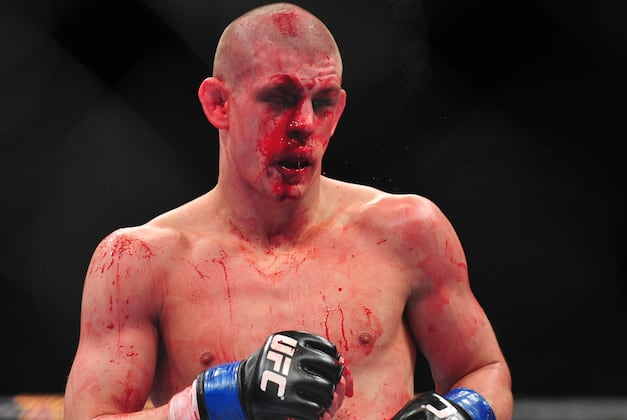 UFC News: Joe Lauzon Posts Photo Collage of Face Healing After Jim Miller Fight
