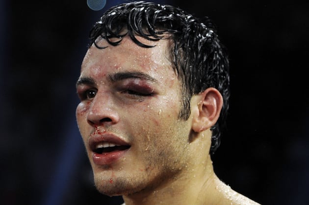 Arum Expects Chavez Jr. Back in May or June
