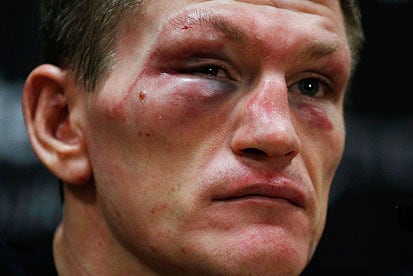 Ricky Hatton: Pacquiao Should Retire 100%