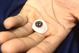 Marquette Player's Eyeball Popped out (PHOTO)