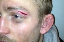 Swedish MMA Federation Stands by Decision to Pull Alexander Gustafsson