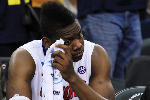 Gators Power Forward Will Yeguete Could Face Offseason Surgery to Right Knee