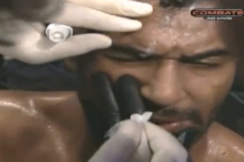 Fighter Accidentally Glues His Eye Shut in Between Rounds
