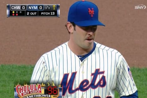 Matt Harvey Pitched with a Bloody Nose