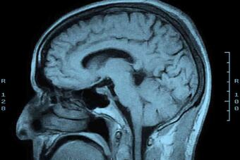 Mri-scan-139eb80abb83dc14b832db5828d91f9a8aee6274-s6-c10_crop_north