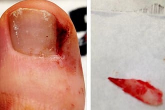 Bryce Harper's Picture of Gross Toenail Is Gross