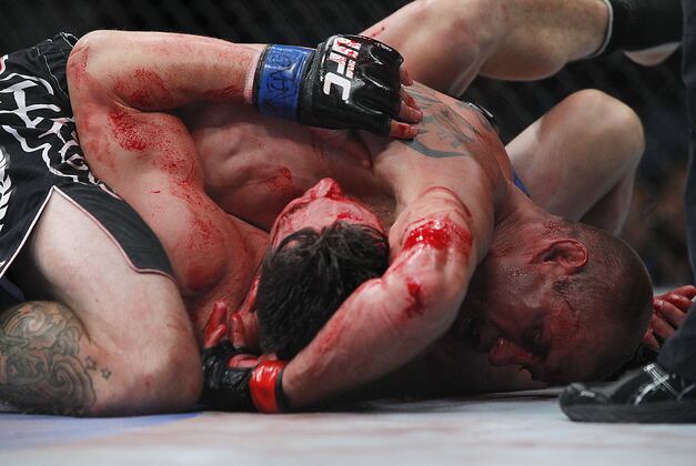 Donald Cerrone Tweets Picture of Nasty Elbow Injury Following UFC 160 Victory