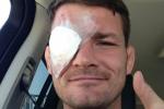 Bisping Undergoes Emergency Eye Surgery