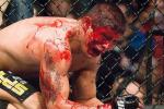 8 Most Soul-Crushing UFC Title Defeats