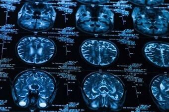 Brainscan_crop_north