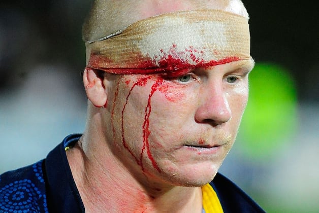 Rugby League Star Accused of 'Biting Opponent's Penis' During Match in Australia