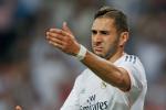 Tackling United's Imposter and Benzema's Hair 