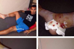 Tevez Unveils Pictures of Bloodied Ankle...
