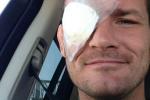 Bisping Heads Back to Hospital with Eye Pain