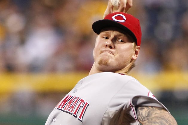 Mat Latos Had Surgery to Remove Bone Chips from Elbow