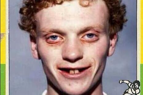 Photo: David Moyes the Player Looks Like Spawn of Satan